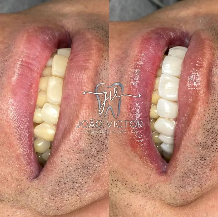 Clínica Odontológica Dr. João Victor: Seu Sorriso em Boas Mãos em Porto de Moz-PA